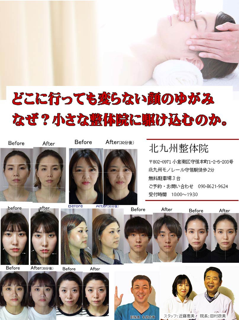 小倉南区北九州整体院の顔 歪み,顎 歪みを解決するページです